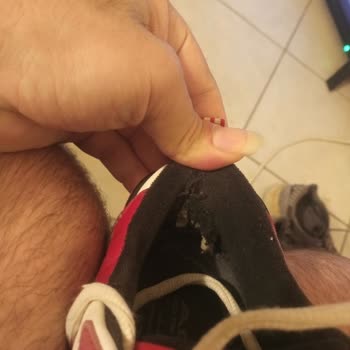 Boyner'den Aldığım Ayakkabının Kalite Sorunu Ve Müşteri Hizmetleri Deneyimi