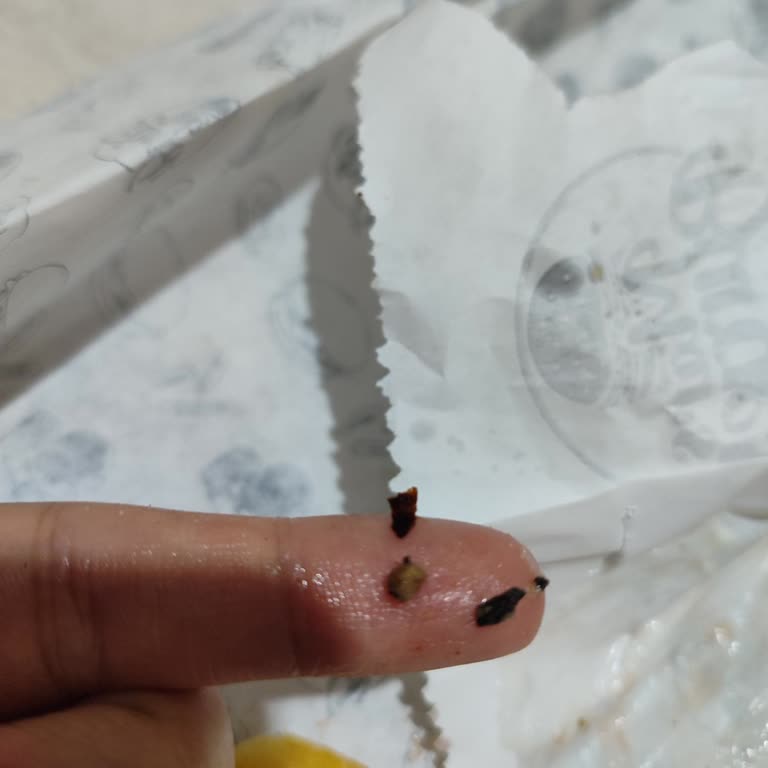 Trendyol GO Siparişimde Taş Parçaları Çıktı!