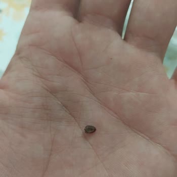 Fıstık Sarma İçinde Taş Ve Kabuğa Rastladım!