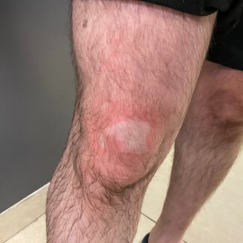 Tehlikeli Lavabo Açıcı: Sağlık Sorunları Ve Hukuki Süreç