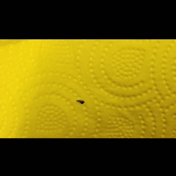 Köftede Bulunan Tehlikeli Yabancı Cisimler