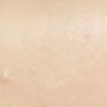 Ciltte Sivilce Ve Kızarıklık Yapan Yüz Yıkama Jeli