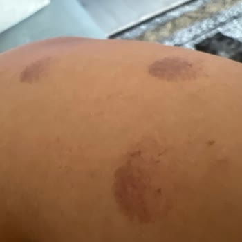 Diyarbakır'da Kötü Güzellik Salonu Deneyimi