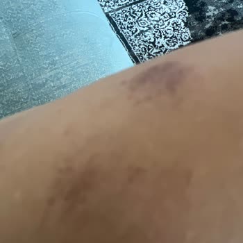 Diyarbakır'da Kötü Güzellik Salonu Deneyimi