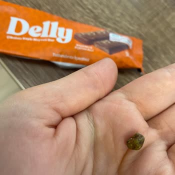 Çikolata İçinden Taş Çıktı, Dişim Kırıldı!