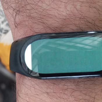 Xiaomi Ürününde Garanti Kapsamı Sorunu