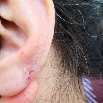 Tecrübesiz Personel Ve İletişimsizlik: Güzellik Merkezinde Hayal Kırıklığı