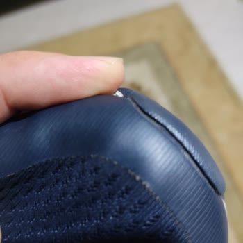 Skechers Ayakkabıda Üretim Hatası Ve Müşteri Hizmetleri Hayal Kırıklığı