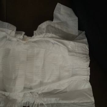 Molfix Bebek Bezlerinde Tek Taraflı Çırtı Sorunu