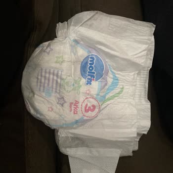 Molfix Bebek Bezlerinde Tek Taraflı Çırtı Sorunu