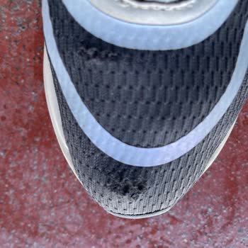 Adidas Ayakkabıda Kalite Sorunu Ve Garanti Hayal Kırıklığı