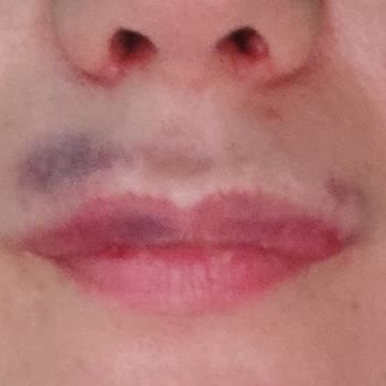 Esma Gülhan Beauty Center Şikayeti