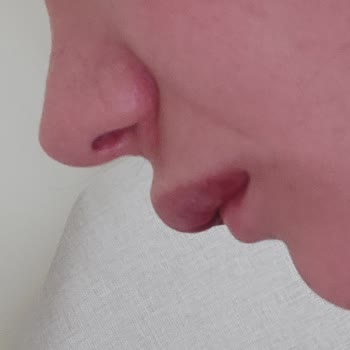 Esma Gülhan Beauty Center Şikayeti