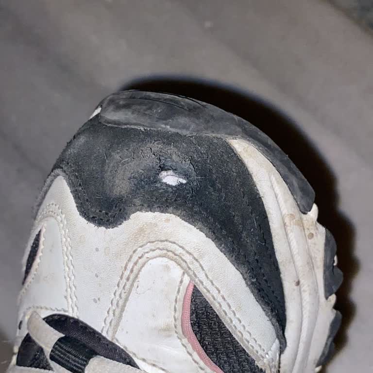 Skechers Ayakkabılarında Kronik Sorunlar