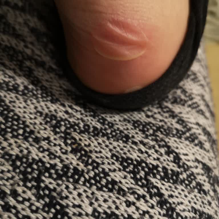 Ergonomik Olmayan Ayakkabı Ve Müşteri Memnuniyetsizliği