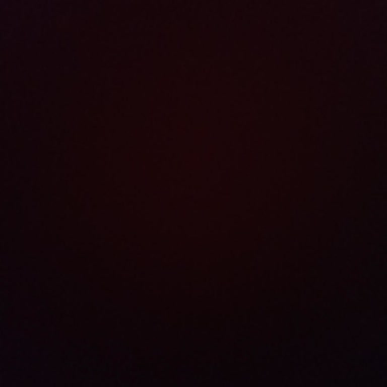 Atasun Optik'te Garanti Hayal Kırıklığı: Prada Gözlük Sorunu