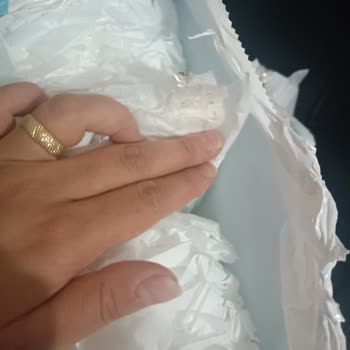 Molfix Bezlerinde Hijyen Sorunu Ve Çamurlu Bantlar