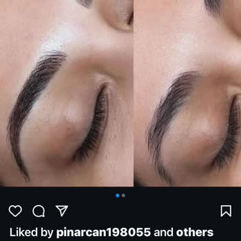 Microblading Mağduriyeti Ve İade Sorunu