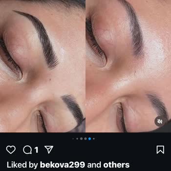 Microblading Mağduriyeti Ve İade Sorunu