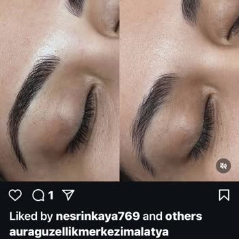 Microblading Mağduriyeti Ve İade Sorunu