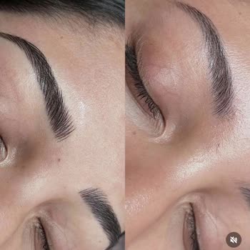 Microblading Mağduriyeti Ve İade Sorunu