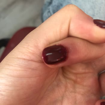 Protez Tırnak Kadıköy Hayal Kırıklığı Ve Sağlık Sorunu!