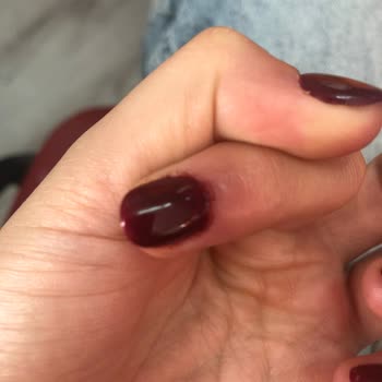 Protez Tırnak Kadıköy Hayal Kırıklığı Ve Sağlık Sorunu!