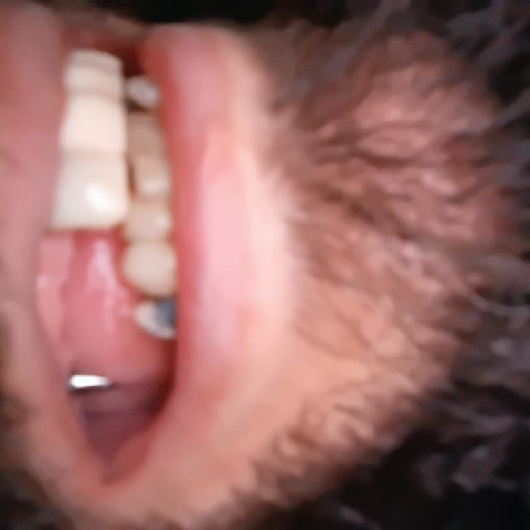 Tedavi Yarım Kaldı: Doktorun Kaybolmasıyla Mağduriyet Yaşıyorum