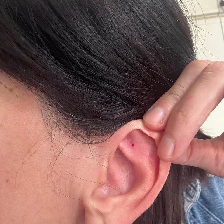 Kiperin Collagen Kullanımı Sonrası Sağlık Sorunları