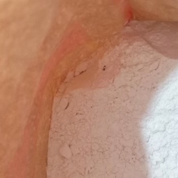 Ürünlerdeki Hijyen Sorunları Ve Tarih Hatası