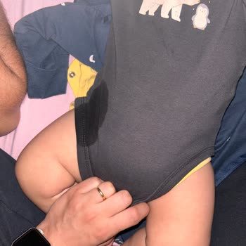 Sleepy Külot Bez Taşırma Sorunu