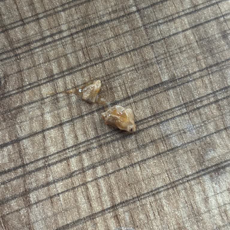 Yeşil Mercimekteki Taşlar Diş Sağlığımı Tehdit Etti