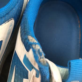 Ameliyatlı Çocuğuma Aldığım Ayakkabı Ciddi Zarar Verdi