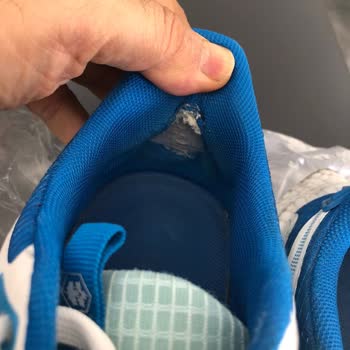 Ameliyatlı Çocuğuma Aldığım Ayakkabı Ciddi Zarar Verdi