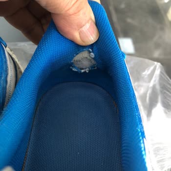 Ameliyatlı Çocuğuma Aldığım Ayakkabı Ciddi Zarar Verdi