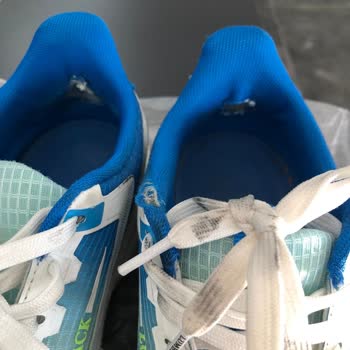 Ameliyatlı Çocuğuma Aldığım Ayakkabı Ciddi Zarar Verdi