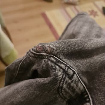 Garanti Süresindeki Kotların Eriyen Noktaları