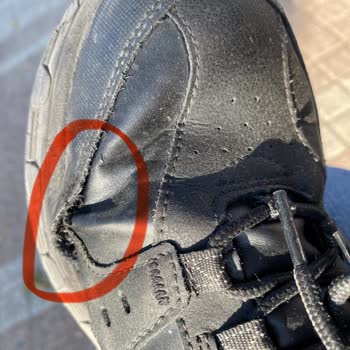Skechers Ayakkabıda Kullanıcı Hatası İddiası Ve Hayal Kırıklığı
