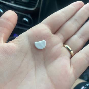 Kreşteki İhmaller Ve Kaba Tavırlar Kızımın Psikolojisini Altüst Etti