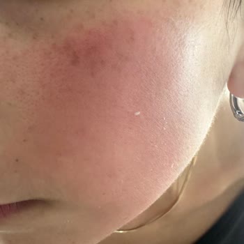 Elite Plus Güzellik Merkezi (Gaziemir) Mağduriyet Sonrası İletişim Sorunu