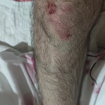 Başıboş Köpekler Güvenliğimizi Tehdit Ediyor
