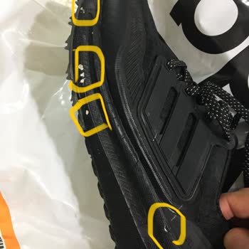 Adidas Ayakkabının Deri Dökülmesi Sorunu
