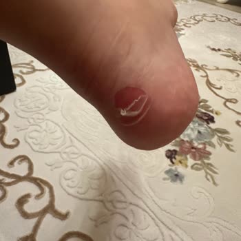 In Street Mağdur Olduk