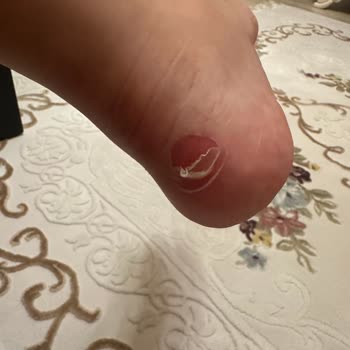 In Street Mağdur Olduk