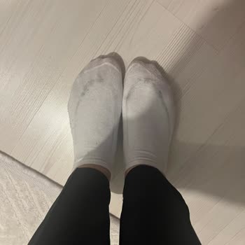 Adidas Ayakkabıda Renk Verme Sorunu