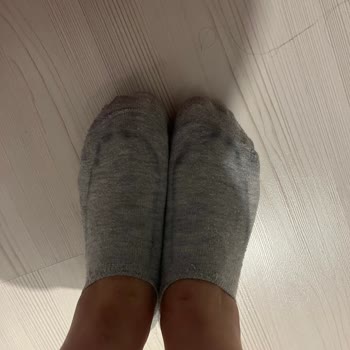 Adidas Ayakkabıda Renk Verme Sorunu