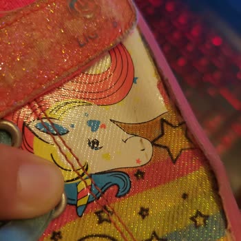 Skechers Ayakkabı 2 Ayda 4 Yerinden Parçalandı