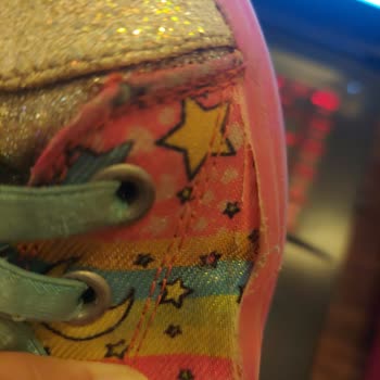 Skechers Ayakkabı 2 Ayda 4 Yerinden Parçalandı