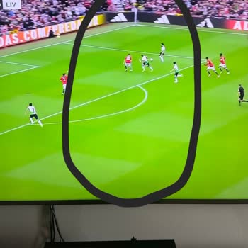 Philips TV Servis Sürecindeki Uzun Gecikme