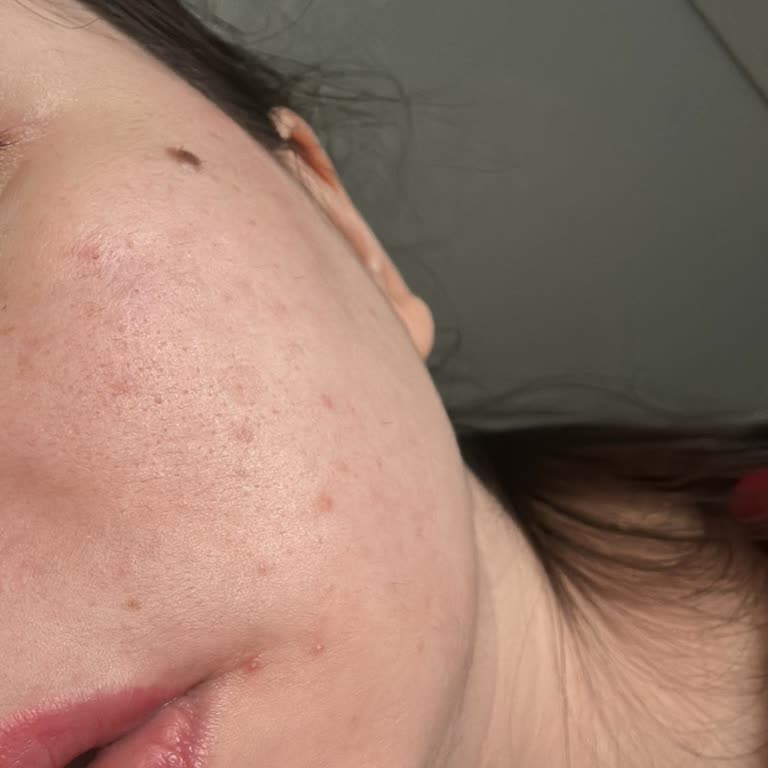 Cyrene (cyrene.com.tr) Pahalı Ürünler Cilt Sorunlarına Sebep Oluyor